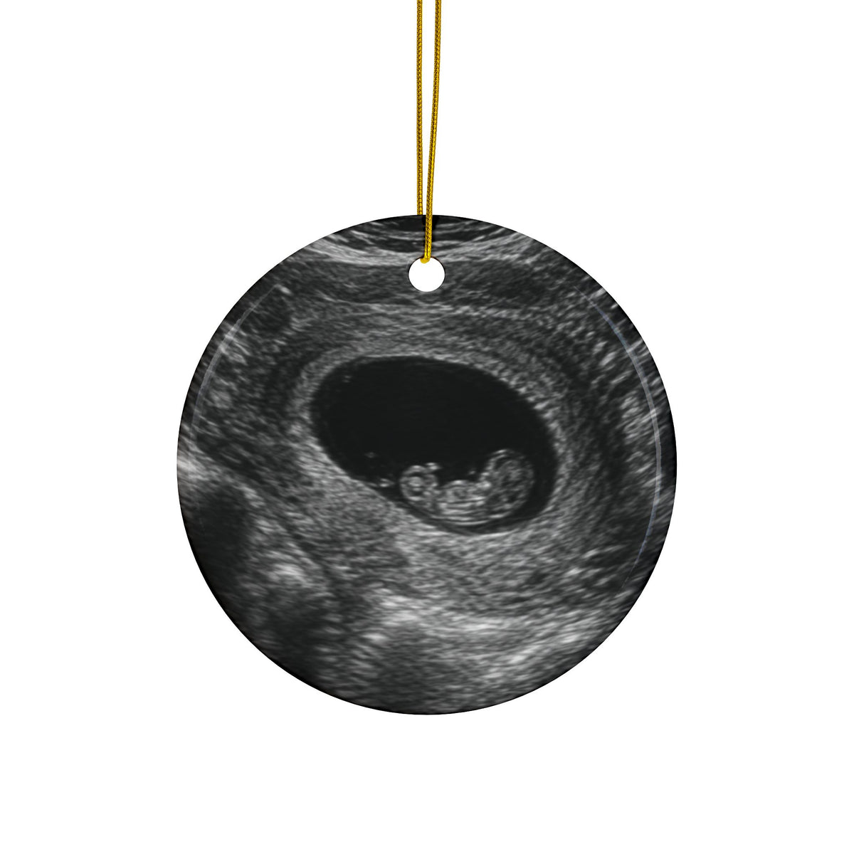Back of the brown bodysuit pregnancy announcement ornament, printed with your own ultrasound photo