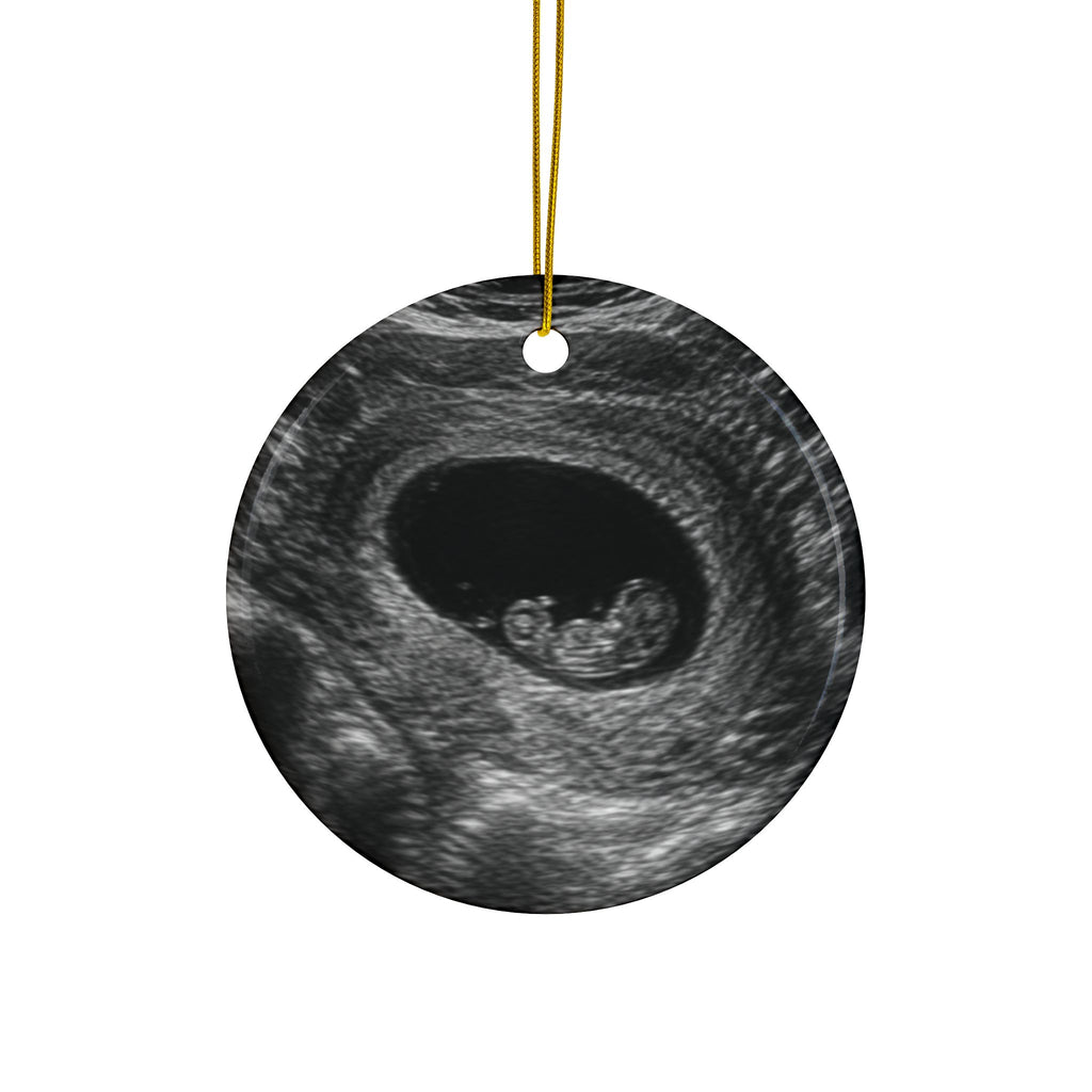 Back of the green sleeper pregnancy announcement ornament, printed with your own ultrasound photo
