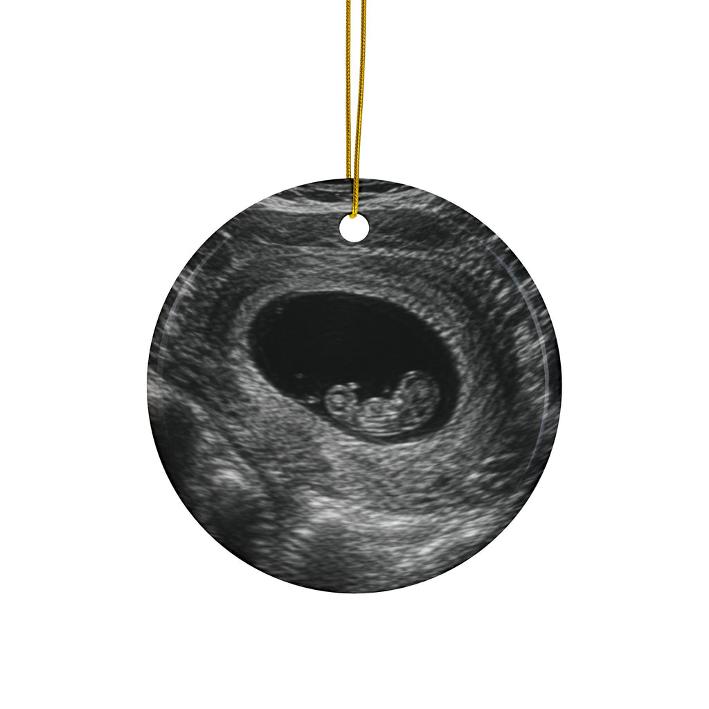 Back of the knit hat and stocking pregnancy announcement ornament, printed with your own ultrasound photo