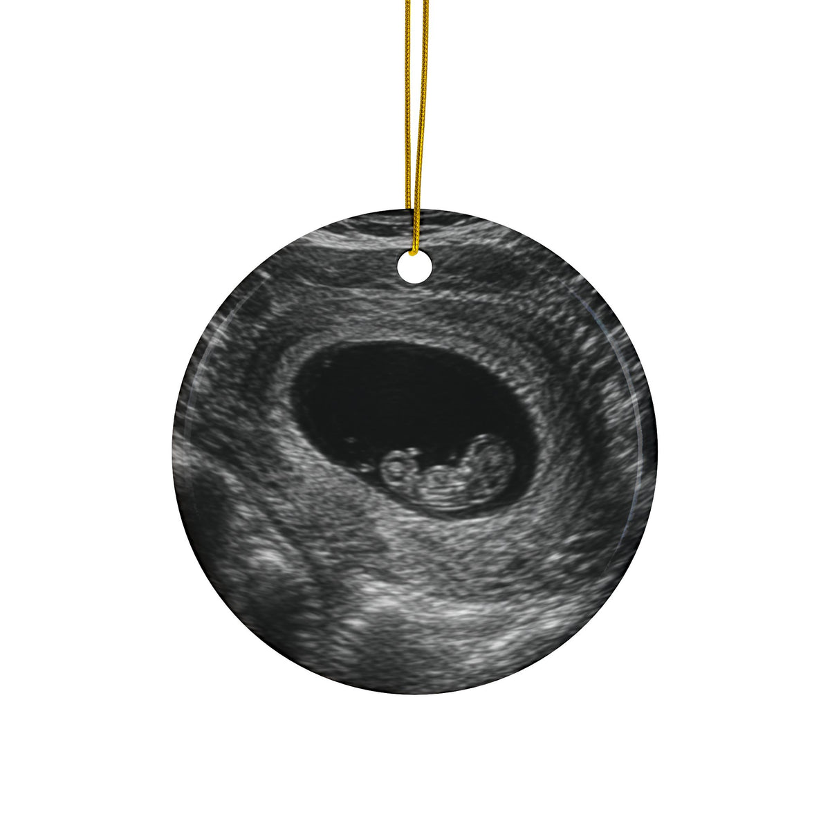 Back of the knit hat and stocking pregnancy announcement ornament, printed with your own ultrasound photo