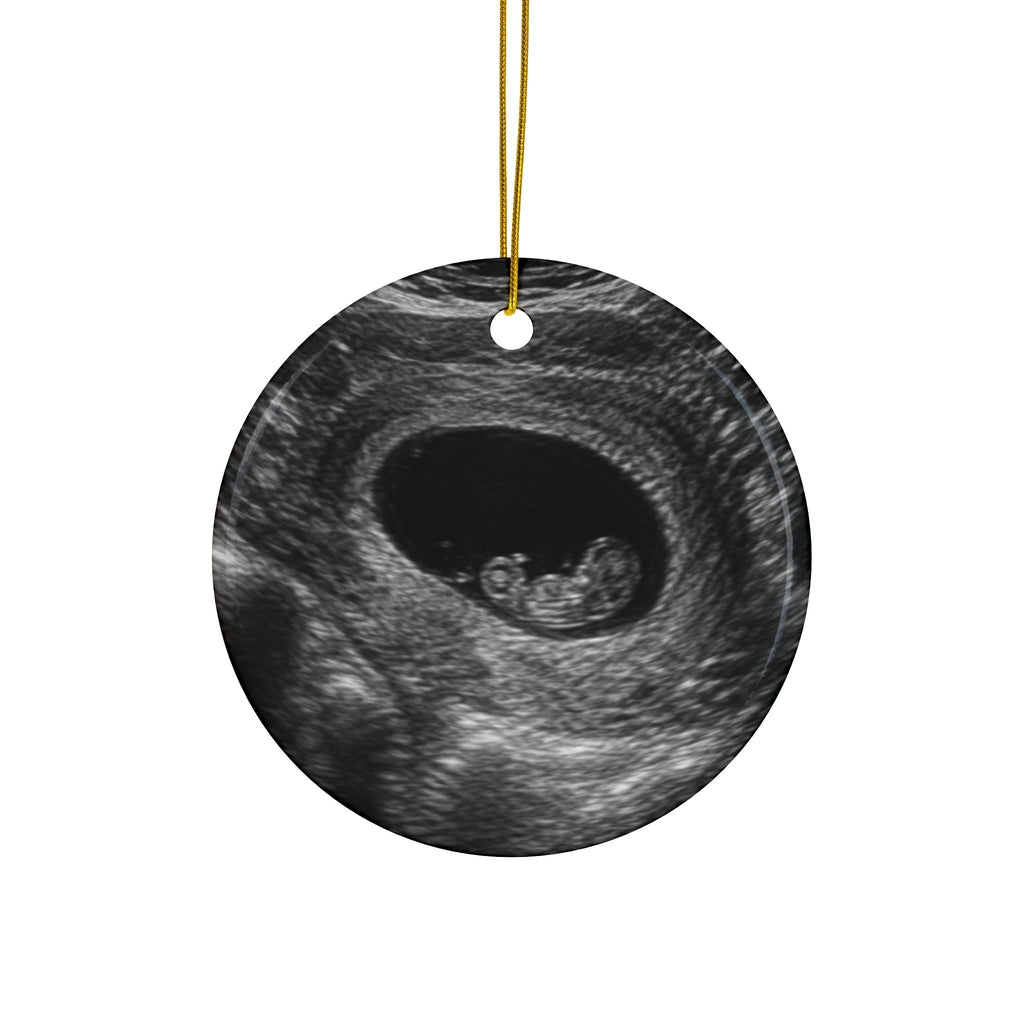Back of the scarf and mittens pregnancy announcement ornament, printed with your own ultrasound photo