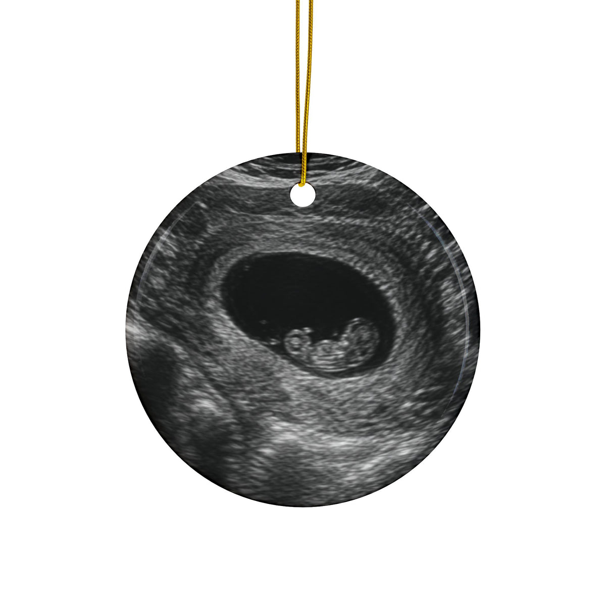 Back of the scarf and mittens pregnancy announcement ornament, printed with your own ultrasound photo